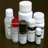 依斯卡合劑（CAS:8007-09-8） 瑞齊生物旗下試劑批發(fā)銷售供應(yīng)網(wǎng)的專業(yè)解析